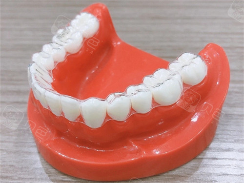 long8：新价格揭秘！2024年牙齿矫正价格多少钱更新：金属托槽5800+自锁托槽8800+隐形矫正1(图2)