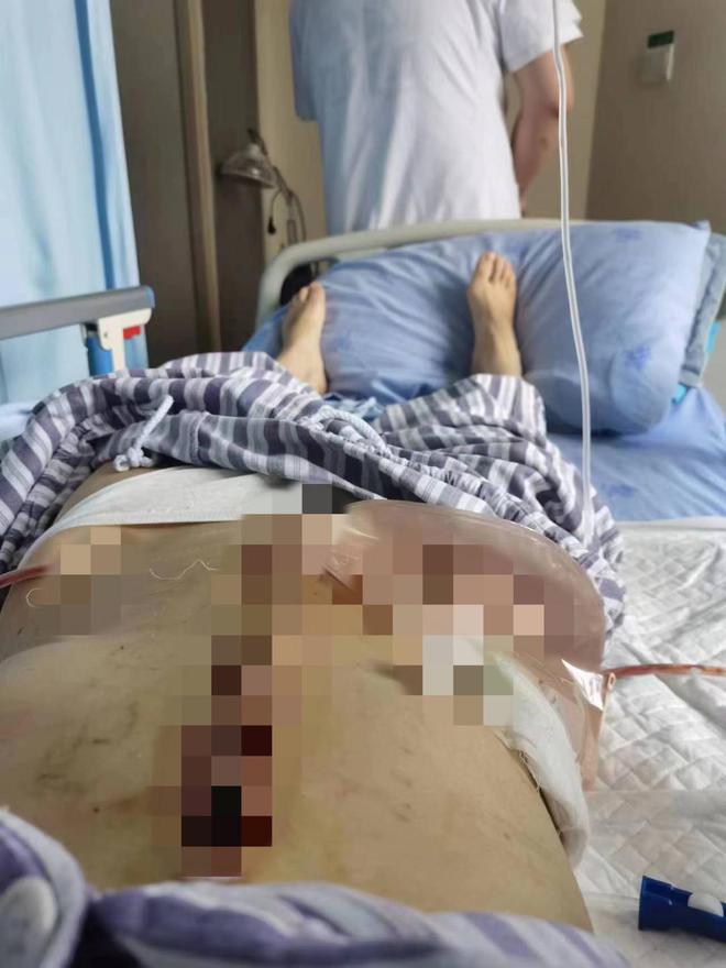 “女子两年被家暴16次”案件举行庭前会议当事人：不敢看丈夫的脸双方都想申请重新验伤(图2)