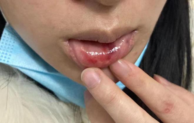 “女子两年被家暴16次”案件举行庭前会议当事人：不敢看丈夫的脸双方都想申请重新验伤(图3)