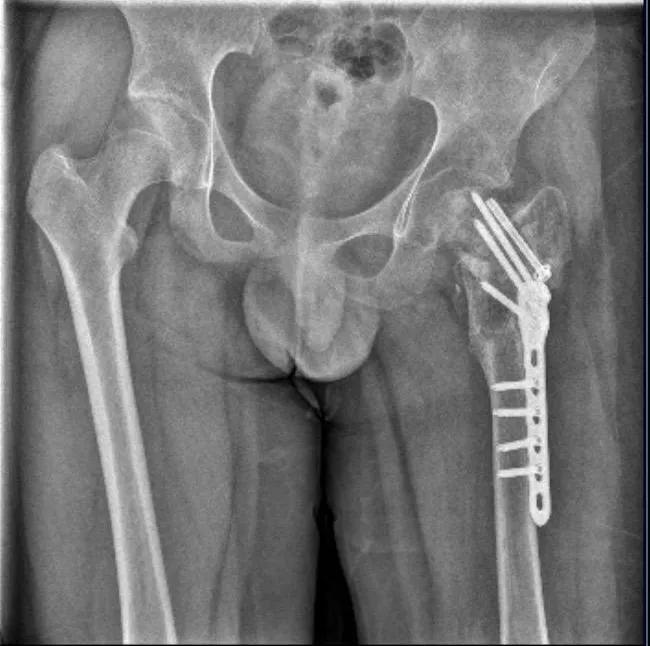 男孩被送矫正基地致半残疾4人被起诉虚假宣传的代价(图4)