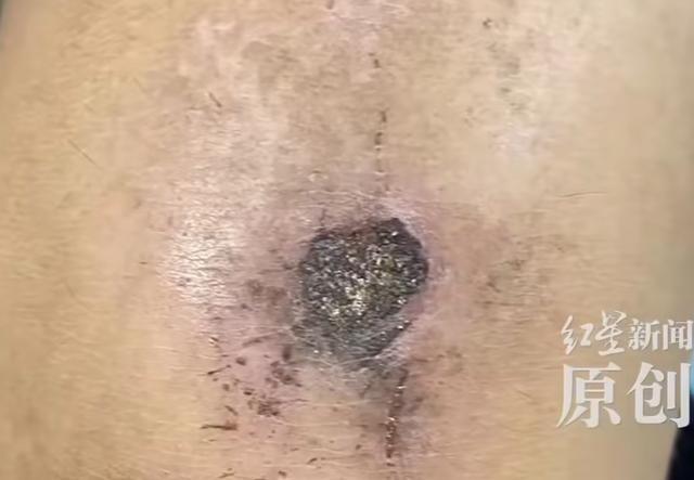 男孩在矫正基地被虐待28天致半残疾该基地号称专治厌学、网瘾对孩子经常殴打、关小黑屋(图3)