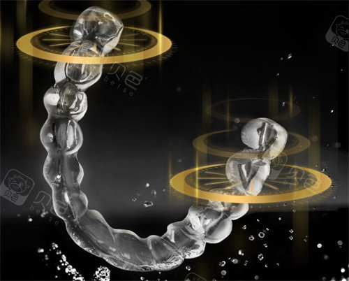 牙齿矫正多少钱价格表2024年？本文为您全部汇总从金属矫正隐形儿牙正畸全汇总！(图3)