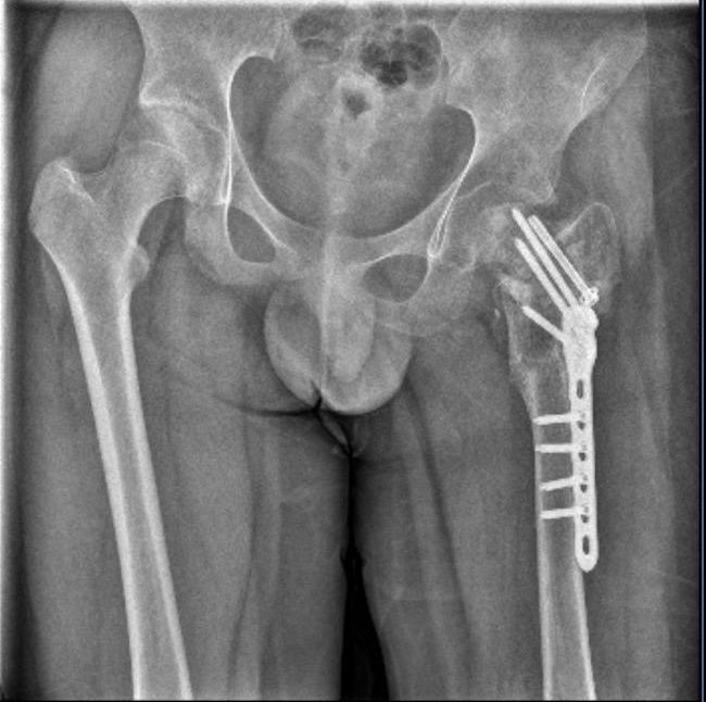 long8：一学生骨折重伤“校长”和3名教官涉嫌虐待被起诉！在“国家二级心理咨询师”办的成长基地接受“踹的教育”？(图4)