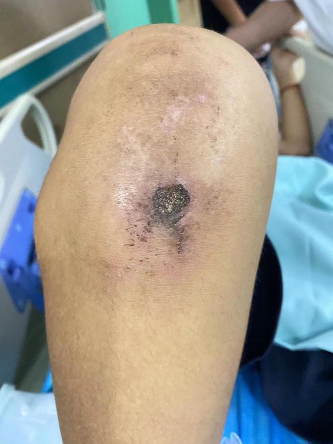 long8：一学生骨折重伤“校长”和3名教官涉嫌虐待被起诉！在“国家二级心理咨询师”办的成长基地接受“踹的教育”？(图3)